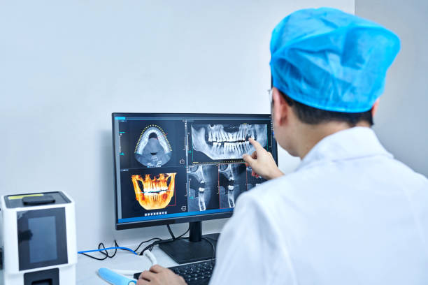Best Emergency Wisdom Teeth Removal in Georgetown, DE